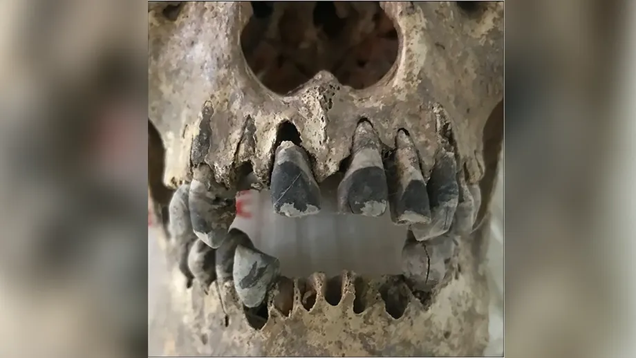 Dentes escurecidos vietnamitas antigos: como comunidades da Idade do Ferro criaram um padrão de beleza com 2.000 anos